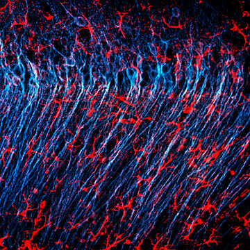 Mikroskopische Aufnahme eines Gehirns, in der Astrozyten und Nervenzellen farbig hervorgehoben sind.